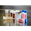Bacteria Tests