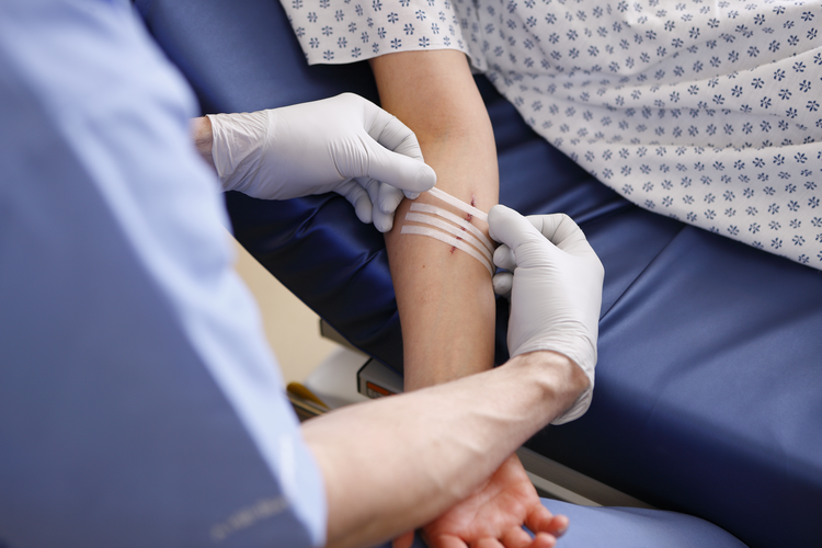 Lasers Could Replace Stitches for Wound Treatment